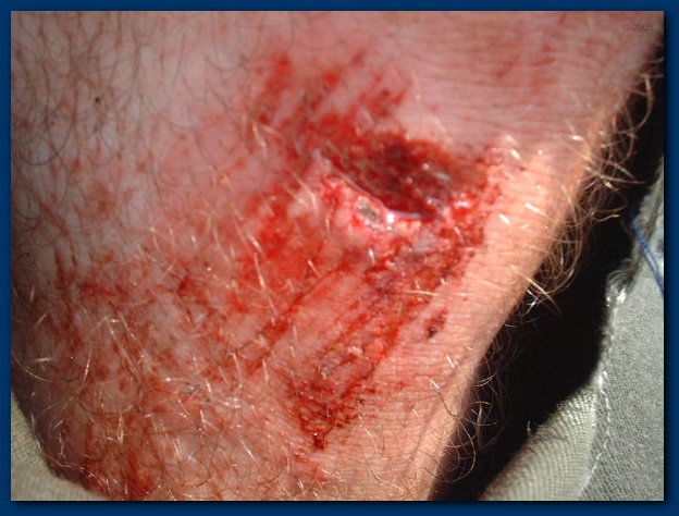 600x449 pixels (110K)